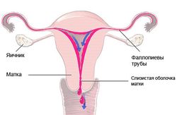 Болезненные менструации – причины и лечение