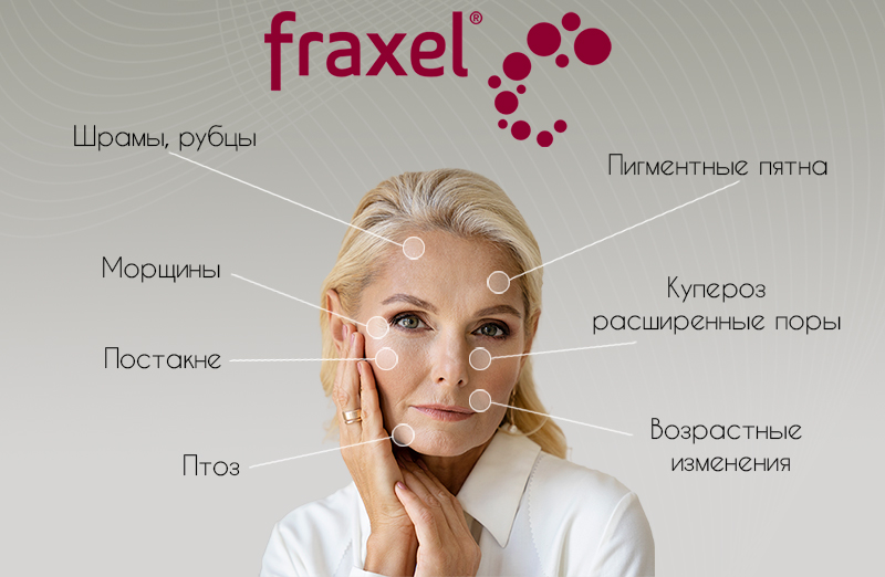 fraxelpok.jpg